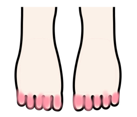 足の指毛